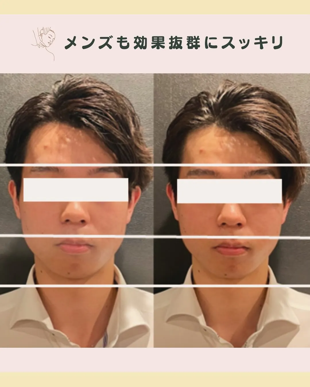 【小顔×肩こり×巻き肩矯正で劇的スッキリ!🌟】